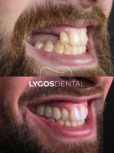 Why Turkey Became a Popular Destination for Dental Treatments in 2025
