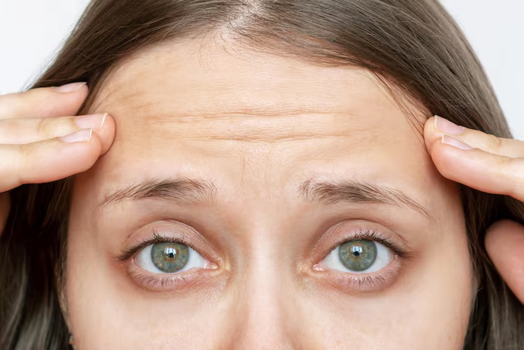 How Frown Lines Treatment Helps Restore a Relaxed Expression